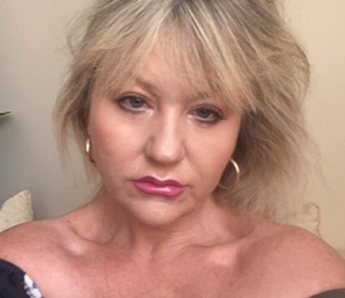 Tin tức đời sống ngày 15/7: Giật mình người phụ nữ dùng sản phẩm hóa học axit để căng da mặt