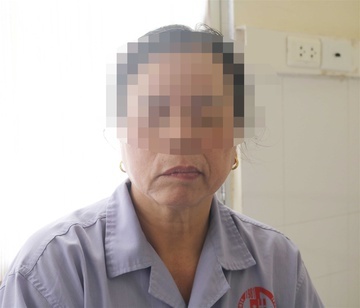 Tin tức đời sống ngày 5/8: Người phụ nữ bất ngờ bị méo miệng sau khi ngủ dậy