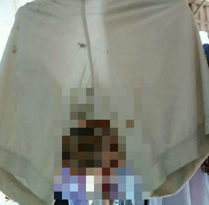 Quay lại phòng trọ sau thời gian nghỉ dịch, nam sinh rợn người khi thấy một thứ dưới chiếc quần đang phơi