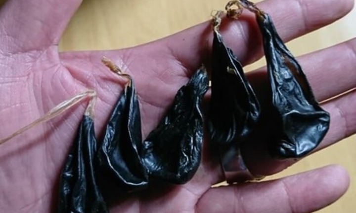 Bé 9 ngày tuổi ngừng thở, ngừng tim vì gia đình cho uống mật khỉ