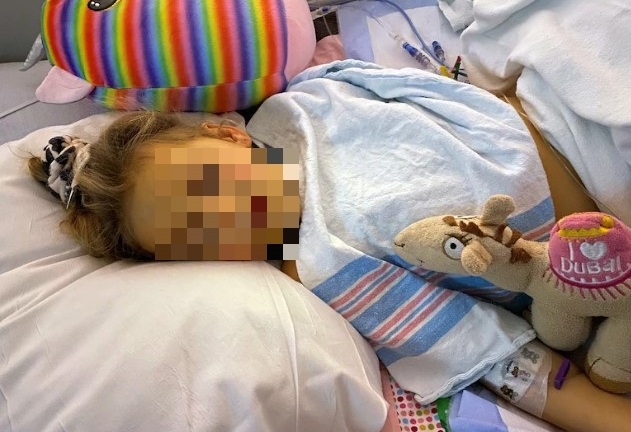 Bé gái 4 tuổi mắc viêm gan bí ẩn và “dấu ấn công chúa” khó quên