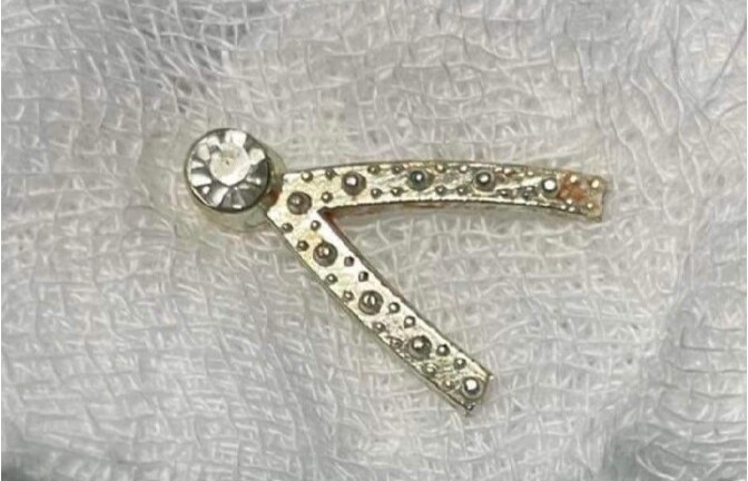 Tin tức đời sống ngày 13/6: Kẹp tóc mắc kẹt trong thực quản bệnh nhi 1 tuổi