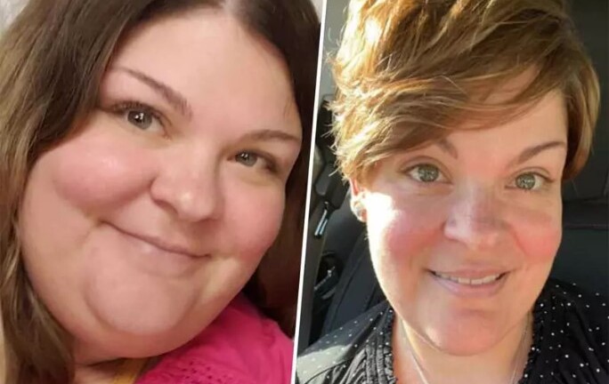 Tin tức đời sống ngày 21/6: Người phụ nữ phát hiện mắc ung thư nhờ giảm cân