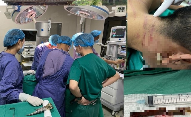 Cứu sống nam thanh niên bị thanh tre 15cm đâm xuyên cổ