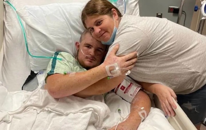 Chàng trai trẻ bị ong sát thủ châu Phi đốt hơn 20.000 vết