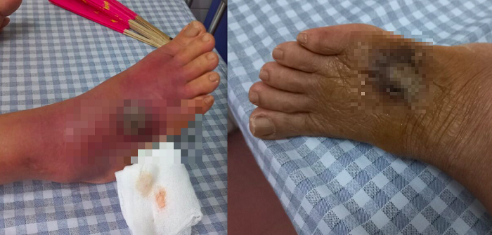 Tin tức đời sống ngày 9/10: Người phụ nữ hoại tử chân sau khi bị chuột cắn