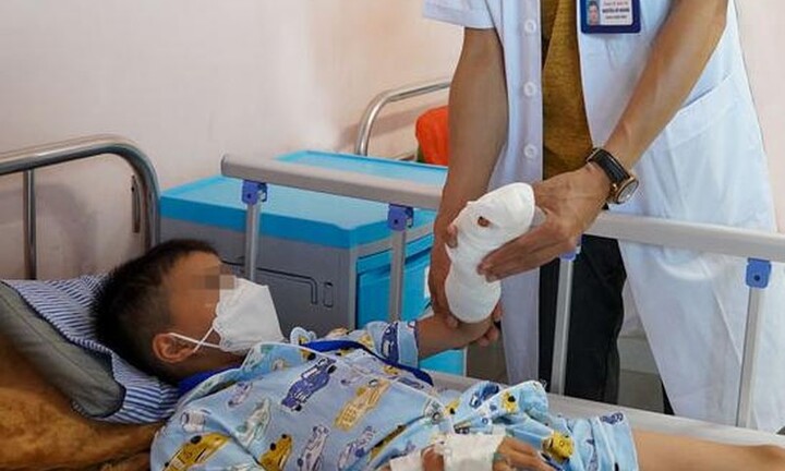 Giúp anh trai nấu ăn, bé 7 tuổi bị đứt gần rời ngón tay