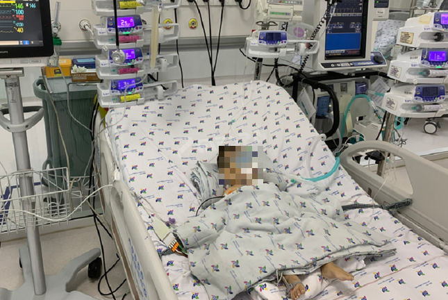 Bé gái 4 tháng tuổi nguy kịch vì viêm cơ tim tối cấp