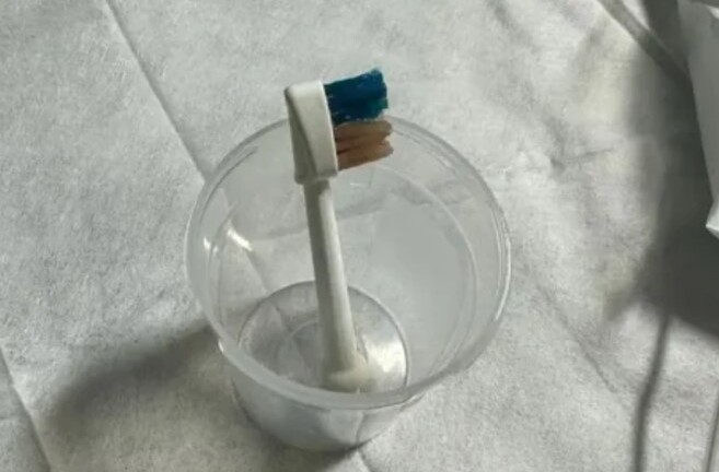 Bác sĩ ngỡ ngàng phát hiện đầu bàn chải điện trong dạ dày bé trai 9 tuổi