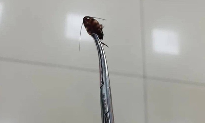 Người đàn ông bỗng thấy có thứ động đậy trong tai, đi khám liền biết chuyện đáng sợ