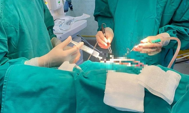 Tin tức đời sống ngày 19/2: Bé trai 14 tuổi bị vết thương sọ não phức tạp