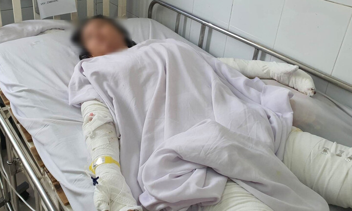 Dùng cồn sát khuẩn nướng mực, 3 người trong một gia đình thương vong