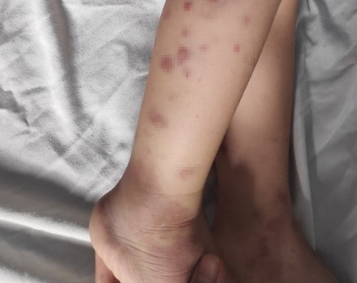 Tin tức đời sống ngày 18/3: Căn bệnh khiến bố mẹ hoảng sợ vì tưởng con bị bạo hành