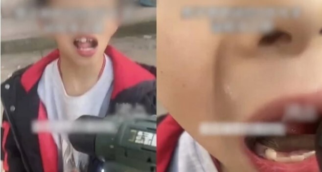 Con trai đau răng đến phát khóc, hành động kinh hãi của người bố khiến ai nấy giật mình