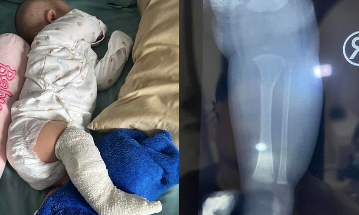 Chân phải của bé trai đột nhiên sưng tấy, bác sĩ kiểm tra xong liền yêu cầu báo cảnh sát