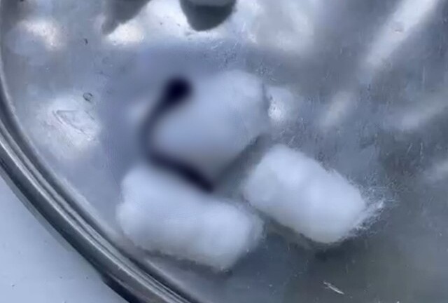 Người phụ nữ chảy máu cam liên tục trong nhiều ngày, đi khám phát hiện thứ kinh hãi