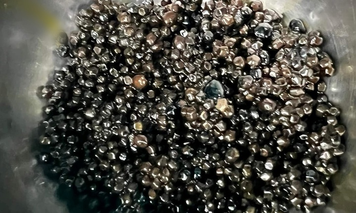 Tin tức đời sống ngày 24/6: Người phụ nữ có hàng nghìn viên sỏi trong túi mật