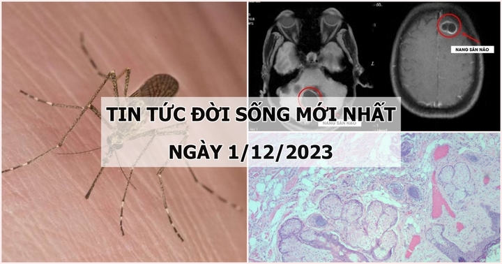 Tin tức đời sống mới nhất ngày 1/12: Cụ ông 94 tuổi sốc phản vệ do bị muỗi đốt