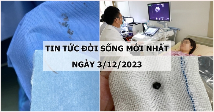 Tin tức đời sống mới nhất ngày 3/12: Mảnh đạn găm trong vùng hàm mặt người đàn ông 56 năm