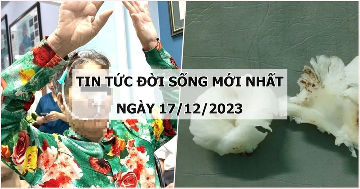 Tin tức đời sống mới nhất ngày 17/12: Người phụ nữ 60 tuổi bị đột quỵ 3 lần trong 4 năm