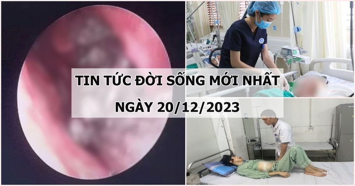 Tin tức đời sống mới nhất ngày 20/12: Hãi hùng phát hiện hơn 100 con giòi sống trong mũi người đàn ông