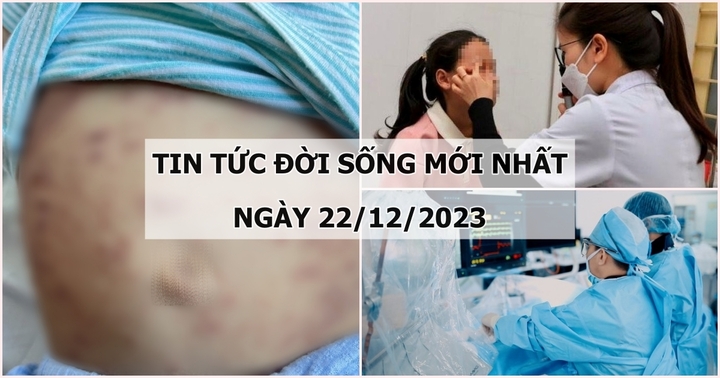 Tin tức đời sống mới nhất ngày 22/12: Bé trai 1 tuổi mắc bệnh hiếm gặp, nổi bóng nước toàn thân