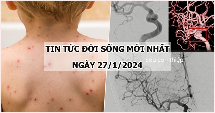 Tin tức đời sống mới nhất ngày 27/1: Đắk Lắk ghi nhận ổ dịch thủy đậu ở một trường mầm non