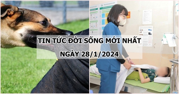 Tin tức đời sống mới nhất ngày 28/1: Bé trai bị chó cắn gây tổn thương nghiêm trọng vùng mặt