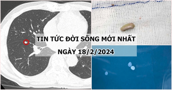 Tin tức đời sống mới nhất ngày 18/2: Sút 4kg/tuần, đi khám phát hiện mắc 2 bệnh ung thư 