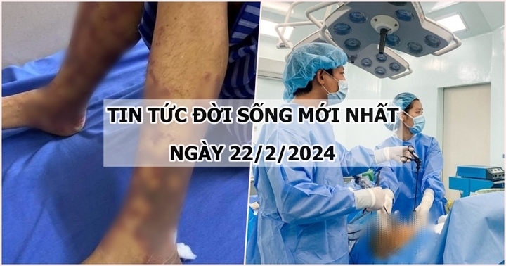 Tin tức đời sống ngày 22/2: Hà Nội ghi nhận bệnh nhân mắc liên cầu lợn đầu tiên trong năm 2024