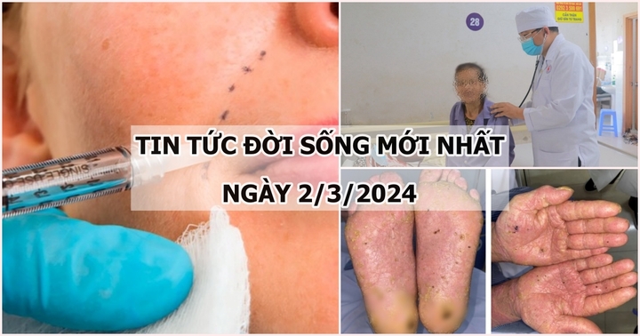 Tin tức đời sống mới nhất ngày 2/3: Người phụ nữ bị áp xe sau khi tiêm filler để