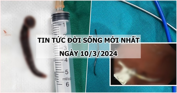 Tin tức đời sống ngày 10/3: Phát hiện đỉa sống dài hơn 5cm trong khí quản của người đàn ông