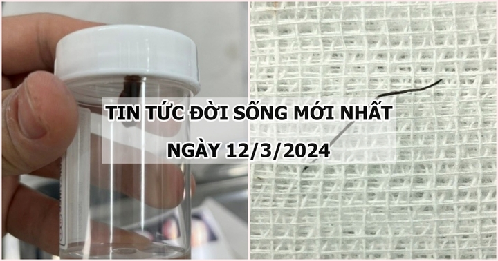 Tin tức đời sống ngày 12/3: Ghim hồ sơ dài gần 2cm đâm thủng thành ruột non, vào trong ổ bụng cô gái