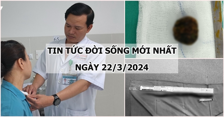 Tin tức đời sống ngày 22/3: Đau quặn bụng không rõ nguyên nhân, đi khám phát hiện điều hãi hùng