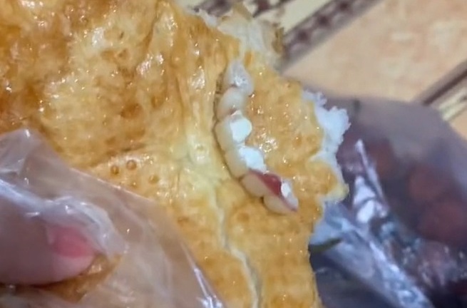 Thanh niên đang ăn bánh mì thì rớt luôn cả hàm răng, dân mạng cố an ủi nhưng không thể nín cười