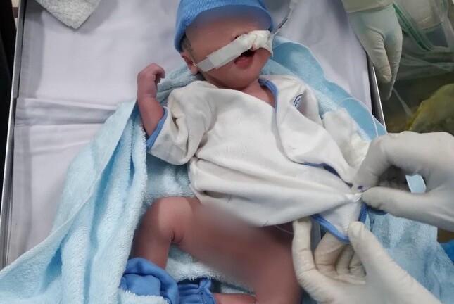 TP.HCM: Bé trai chào đời trong phòng hồi sức điều trị bệnh nhân mắc COVID-19