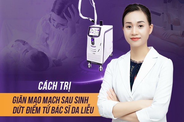 Cách trị giãn mao mạch sau sinh dứt điểm từ bác sĩ da liễu 