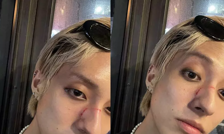 Nam ca sĩ Hàn Quốc bị tấn công trên phố vì là người đồng tính