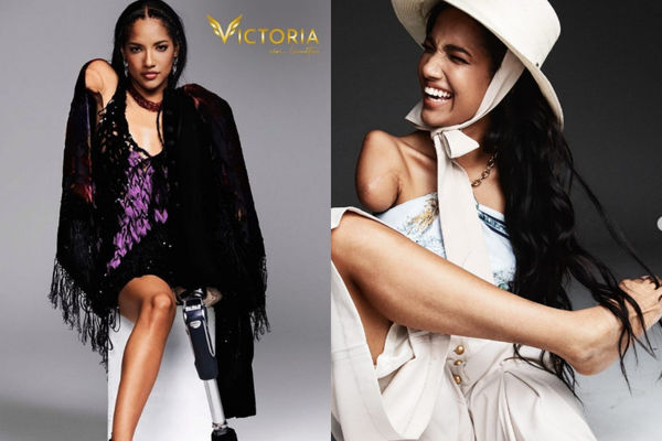 Mất 3 chi vì điện giật khi mới 5 tuổi, cô gái trẻ gây bất ngờ với cuộc sống đầy nghị lực hiện tại