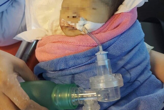 Phát hiện bé gái sơ sinh không mảnh tã giữa rừng, giòi bám đầy người