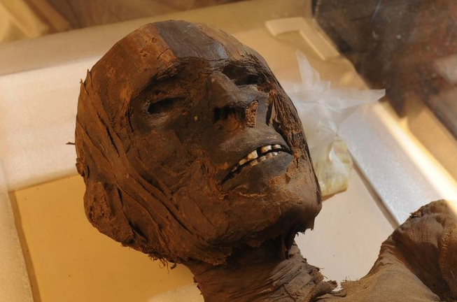 Bí ẩn xác ướp 4.000 năm tuổi có các triệu chứng của bệnh tim