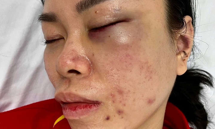 Bắt giữ người đàn ông đánh đập vợ cũ gần một ngày