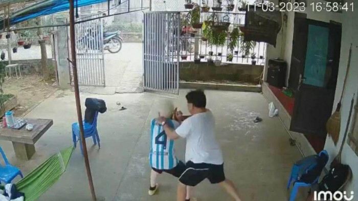 Hà Nội: Điều tra vụ bé trai bạch tạng bị người đàn ông hành hung