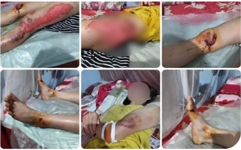 Thực hư thông tin “con tra tấn mẹ bằng cách lấy xe máy kéo lê trên đường” ở Yên Bái
