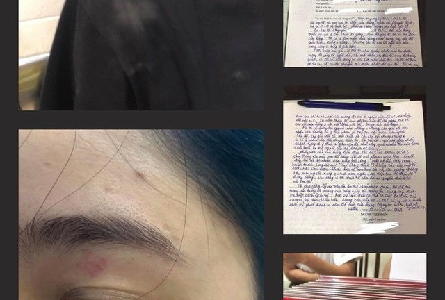 Vụ nhân viên quán bánh mì Nguyên Sinh đánh khách: Giám định thương tích