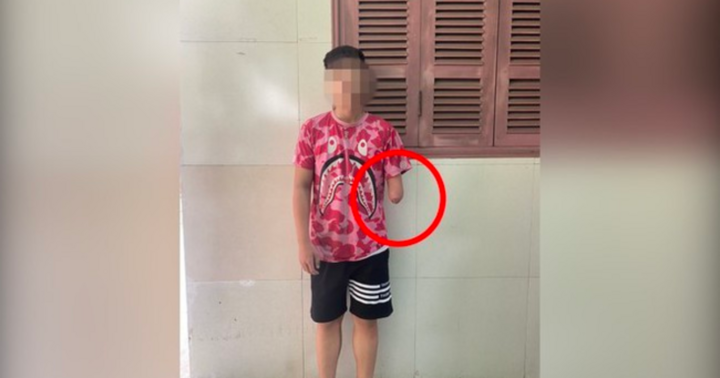 Thiếu niên cụt một tay vẫn lái xe bốc đầu, lạng lách