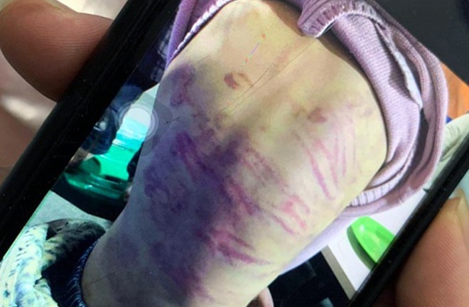 Vụ bé gái ở Hà Nội bị người tình của mẹ xâm hại: Yêu râu xanh xâm hại 9 lần