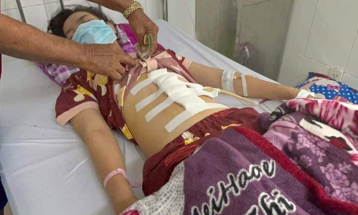 Tình tiết mới vụ thiếu nữ 16 tuổi nghi bị cha dượng đánh dập lá lách, gãy xương sườn