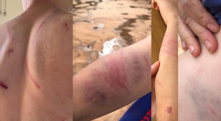 Vụ cháu bé 9 tuổi nghi bị bố và bà nội đánh dã man: Người mẹ tiết lộ sốc