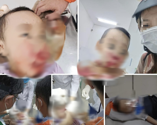 Công an Tiền Giang xác minh vụ người mẹ tố CSGT đánh trúng mặt con trai